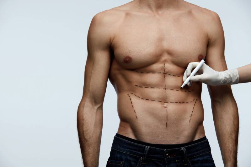 Chirurgie de l’homme Abdominoplastie ou Lifting du Ventre
