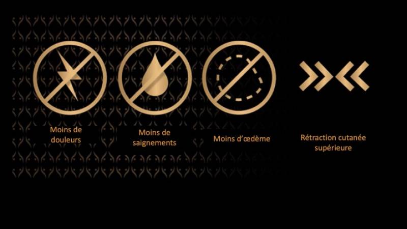 Lipoaspiration Haute-Définition par VASER