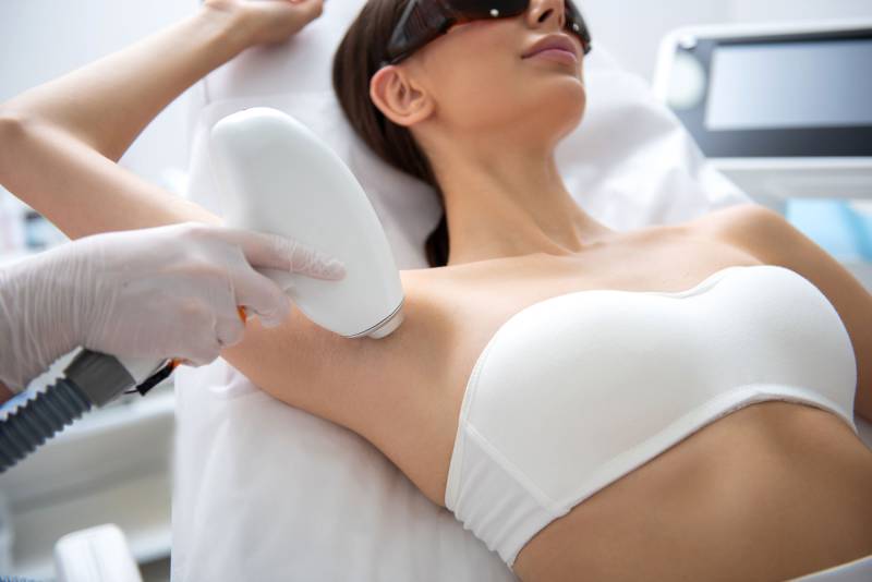 Epilation laser définitive