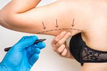 Notre zone d'activité pour ce service Injections d'acide hyaluronique des sillons nasogéniens par un chirurgien esthétique à