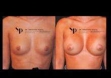 Nos prestations sur le secteur de Aubagne 13400